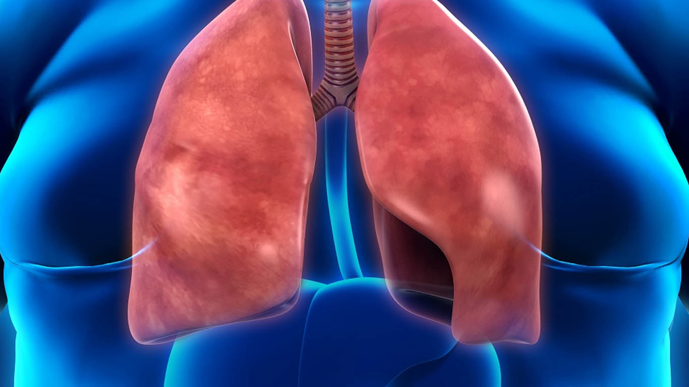 Best Doctor for Lung Infection in Teynampet